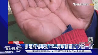 斷兩拇指非殘 中年男申請鑑定\