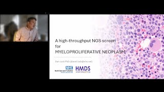 A high-throughput NGS screen for myeloproliferative neoplasms (MPN)