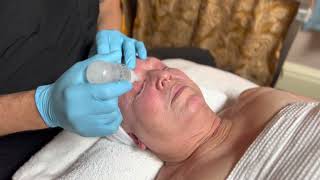 Rick McCoy LMA,CME Explains Thermage FLX Eye Treatment at Cascades MedSpa