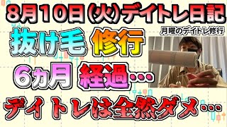 【デイトレ＆スイング結果】脱毛予防の薬を飲んで６ヵ月、、、ちなみにデイトレは３連敗中です、、、