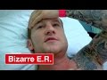 Surgery On A Broken Jaw That Has Been Left For 10 Days - Bizarre ER