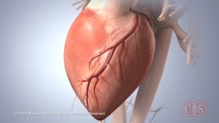 Symptoms of Sudden Cardiac Arrest | Cedars-Sinai