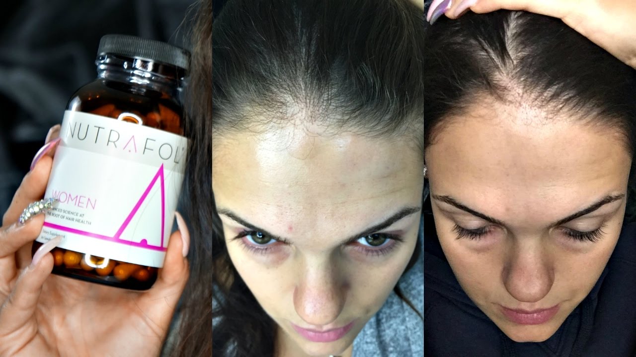 Nutrafol Hair Growth Testing & Review - YouTube