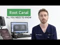 What is a Root Canal? - Your Complete Guide with 123 Dental