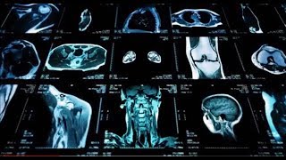 Augmenting Radiology with AI
