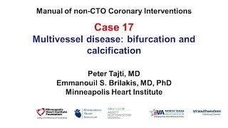 Case 17: PCI Manual: bifurcation and calcification