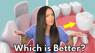 Dental Veneers vs. Crowns | Which is Better & What's the Difference