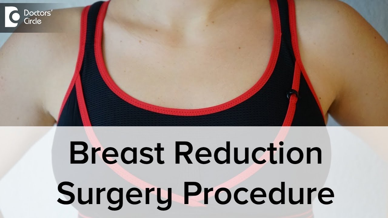 How Is A Breast Reduction Surgery Done? - Dr. Srikanth V - YouTube