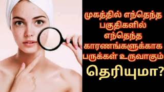 முகத்தில் எந்தெந்த பகுதிகளில் எந்தெந்த காரணங்களுக்காக பருக்கள் உருவாகும்..தெரியுமா?