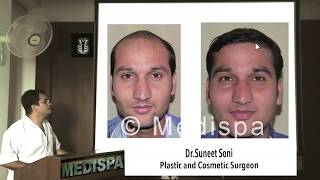 How to choose a Hair Transplant Surgeon, FUT or FUE, Cost, Medispa By Dr Suneet Soni Jaipur Delhi