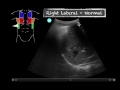 POCUS - Teaching Point - Ultrasound vs CXR in pneumonia