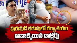 Doctors Find Uterus And Vaginal Tissue In Man's Stomach | SumanTV