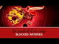Blocked Arteries