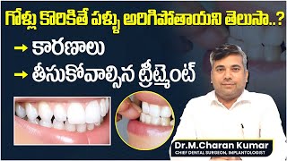 గోళ్లు కొరికితే పళ్ళు అరిగిపోతాయని తెలుసా..? |Teeth Attrition  Causes | Eledent Dental Hospitals