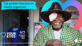 Sight, vision and UniProt proteins