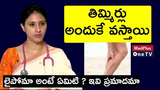 Tingling in Hands and Feet | Common Causes of Tingling | Dr.Samatha Tulla | MedPlusOneTV