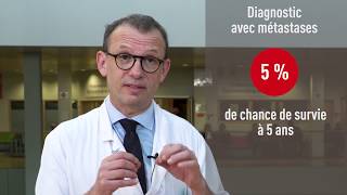 Traiter le cancer colorectal métastatique