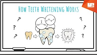 How Teeth Whitening Works