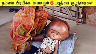 உலகையே வியக்கத்தக்க குழந்தைகள் Most Unusual Kids You Won't Believe Untill Now | கலாட்டா தகவல் தமிழ்