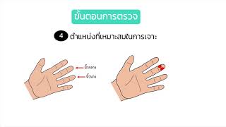 สื่อ ชุดการคัดกรองโรคเรื้อรัง เรื่อง การคัดกรองโรคเบาหวานด้วยการเจาะน้ำตาลปลายนิ้ว