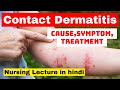 contact dermatitis | cause, symptoms, treatment, nursing care | nursing lecture in hindi | msn