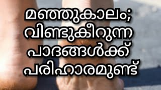 മഞ്ഞുകാലം; വിണ്ടുകീറുന്ന പാദങ്ങള്‍ക്ക് പരിഹാരമുണ്ട്||M4 Tips||malayali youtuber||Ep:213