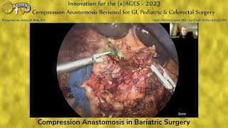 Compression Anastomosis in Bariatric Surgery