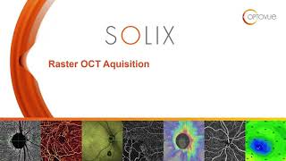 Solix Raster Acquisition