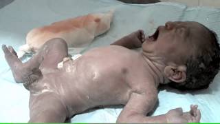 Basic Neonatal Care