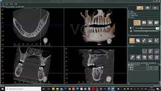 CBCT SOFTWARE DEMONSTRATION