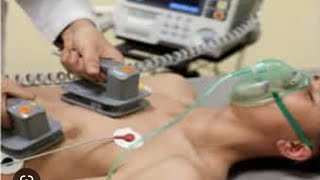 ACLS Mega Code Review - Unstable Tachycardia and Synchronized Cardioversion