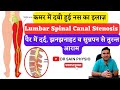 Lumbar Spinal Canal Stenosis Exercises in Hindi | 7 Best Exercises to Avoid Surgery #sciatica