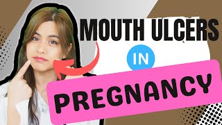 Pregnancy and Mouth Ulcers (Pharmacist Approved Medication Treatments)