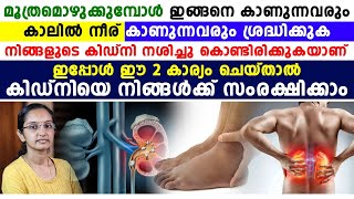 മൂത്രമൊഴിക്കുമ്പോൾ ഇങ്ങനെ കാണാറുണ്ടോ | കിഡ്നി നശിക്കുന്നതിന്റെ ലക്ഷണങ്ങൾ | KIDNEY FAILURE SYMPTOMPS