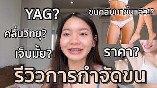 รีวิวการกำจัดขนทั้งหมด! ขนรักแร้ ขนขา ขนน้องสาว คลื่นวิทยุ? YAG? ขนกลับมาขึ้นใหม่? I Magiccan