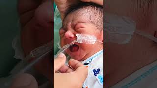 Nasogastric (NG) Tube Insertion in Neonate/Newborn | Orogastric (OG) Tube/Feeding Tube | Paediatric