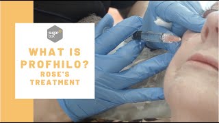 How does Profhilo work