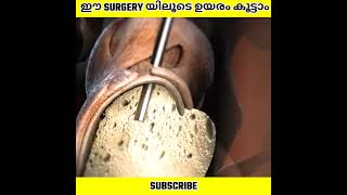 ഉയരം കൂട്ടുന്ന SURGERY | Leg lengthening surgery | Infinite Facts |  #shorts