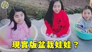 重慶3姐妹生下來就住洗臉盆,翻個身都會骨折,今走紅網路吸粉百萬！｜折疊人｜奇跡｜明星觀察員