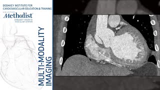 Multimodality Case Presentations: with Advanced CV Imaging Fellows (Dipan J. Shah, MD) June 18, 2019