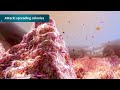 AQUACEL® Ag+ Extra™ Dressings - Specifically developed to win the battle against BIOFILM