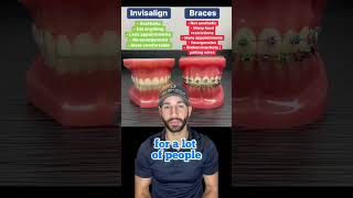 Do you NEED Invisalign or braces? The answer may surprise you.