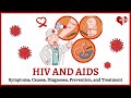 What is HIV and AIDS? - Symptoms, Causes, and Treatment Explained