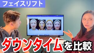 【フェイスリフト】ダウンタイムを比較【モニター５名の結果】