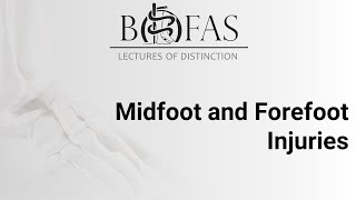 Midfoot \u0026 Forefoot Injuries - BOFAS Lectures of Distinction