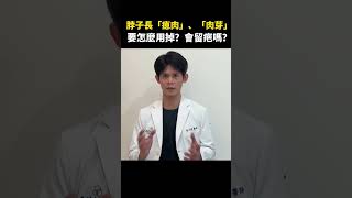 🔎脖子長肉芽、瘜肉，要怎麼用掉？會留疤嗎？醫師親自來解答！▏皮膚科黃千耀醫師