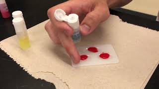 TJs Anatomy - Blood Typing Lab Demonstration