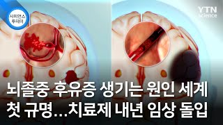 뇌졸중 후유증 생기는 원인 세계 첫 규명...치료제 내년 임상 돌입 / YTN 사이언스