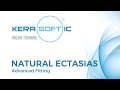 Natural Ectasias - Advanced Fitting