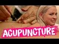 Acupuncture MIRACLE?! (Beauty Trippin)